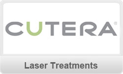 laser-treatments